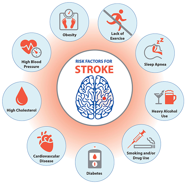 An image depicting the risk factors for stroke , obesity, lack of exercise, sleep apnea, heavy alcohol use, smoking or drug use, diabetes, cardiovascular disease, high cholesterol, and high blood pressure