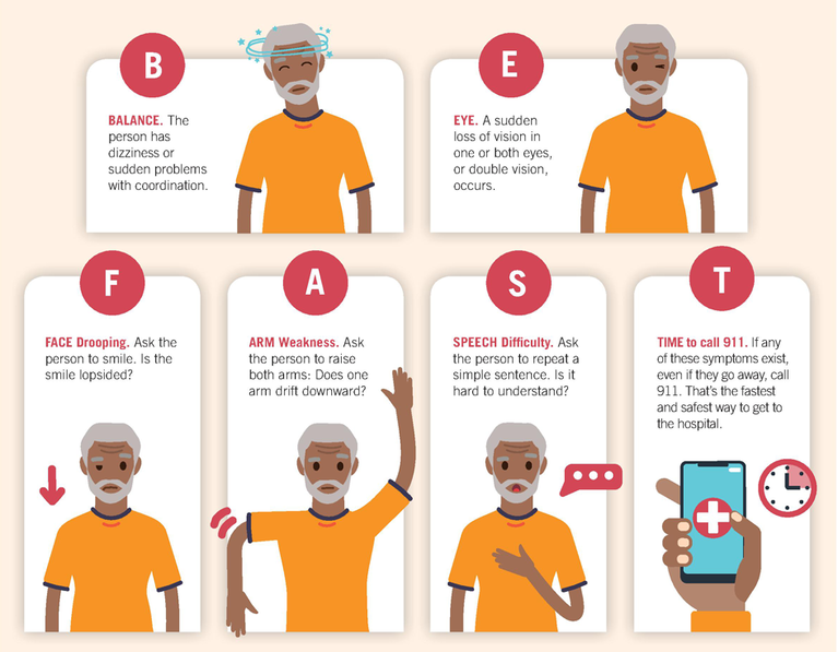 An image showing the signs of a stroke according to the BE FAST acronym from Newark Beth Israel Medical Center 